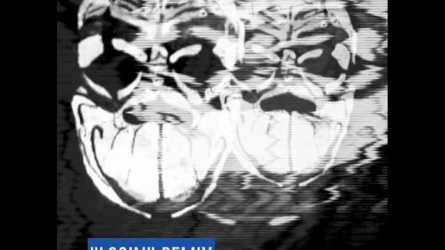 Phinx - "Login" (DJ SPADA RMX) смотреть онлайн