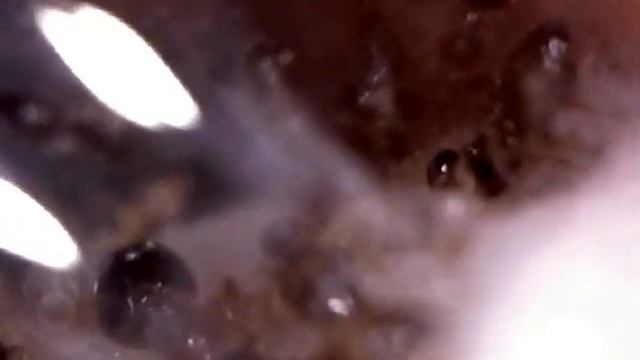 Crematogaster biroi (02) смотреть онлайн