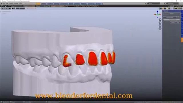 Blender for Dental - Bleaching Add On смотреть онлайн