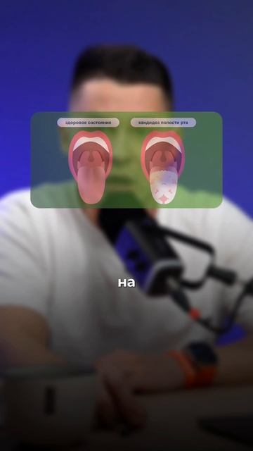 Кандиды у детей смотреть онлайн