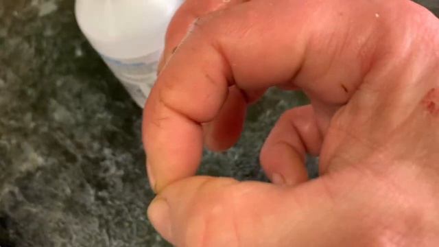 Курицу контролёра опять побили🤦🏼_♀️останавливаю кровь из хохолка разными способами и что помогло ✅ смотреть онлайн