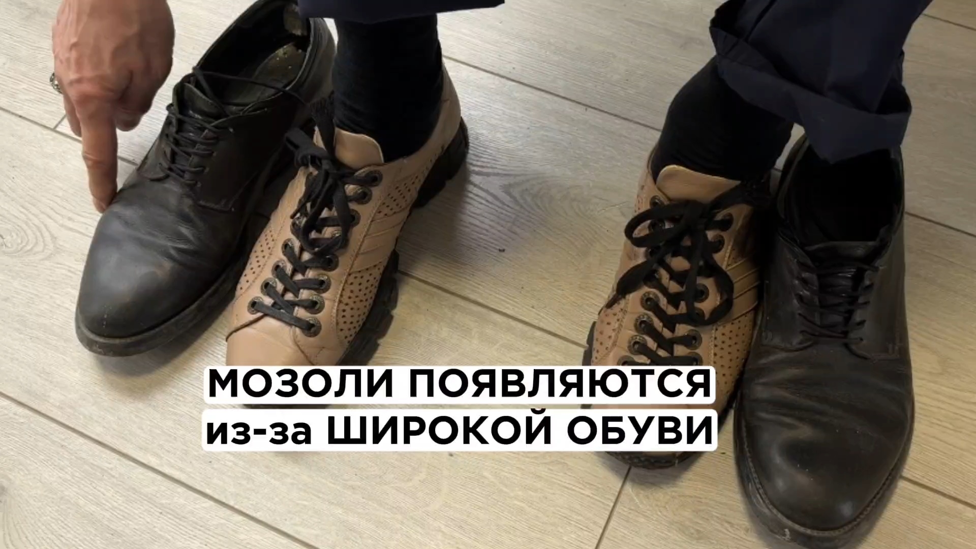 Появилась мозоль на мизинце? Обратите внимание на ширину обуви смотреть онлайн