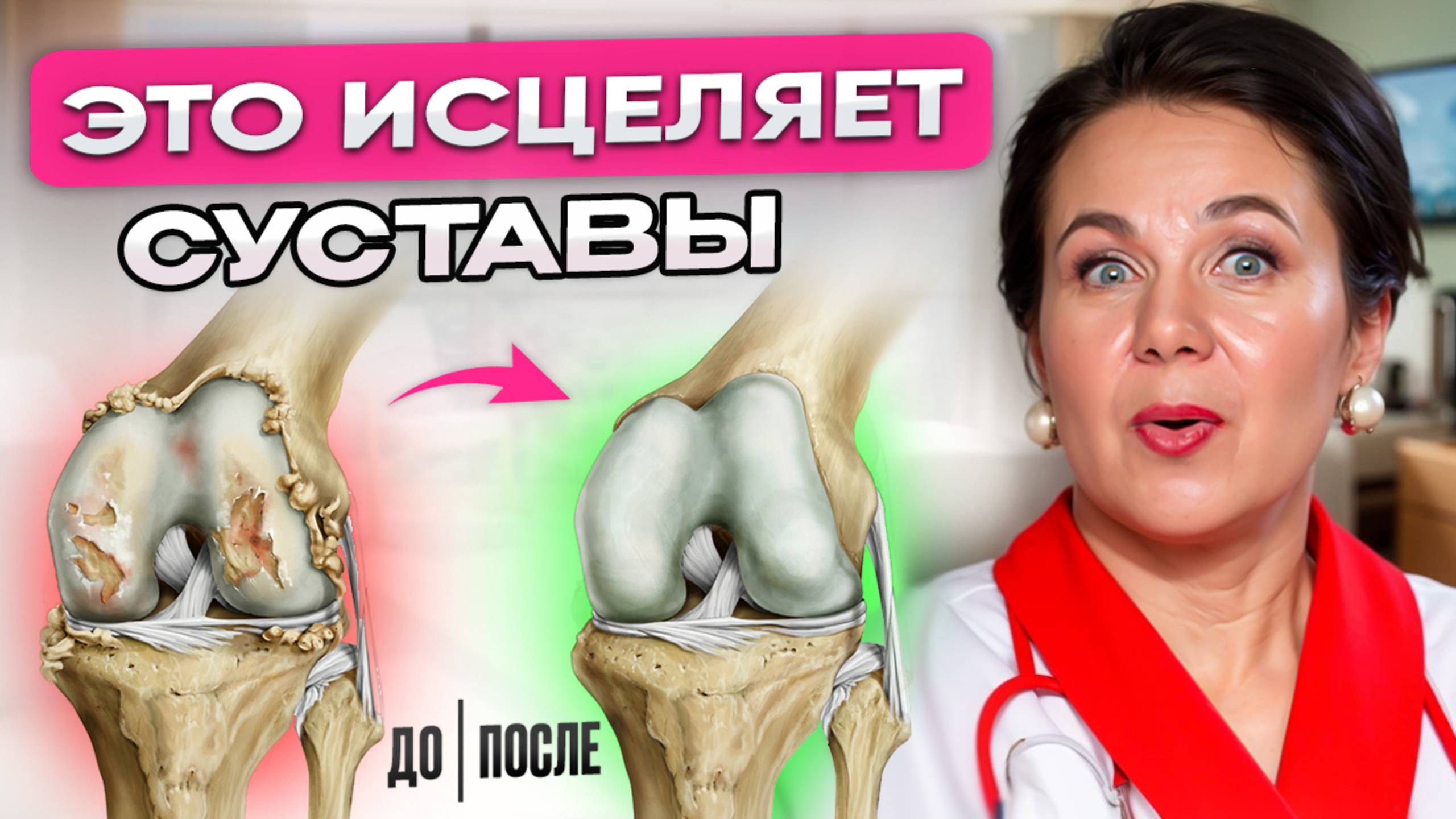 Как вылечить суставы БЕЗ МАЗЕЙ и БЕЗ УКОЛОВ за 60 минут? смотреть онлайн
