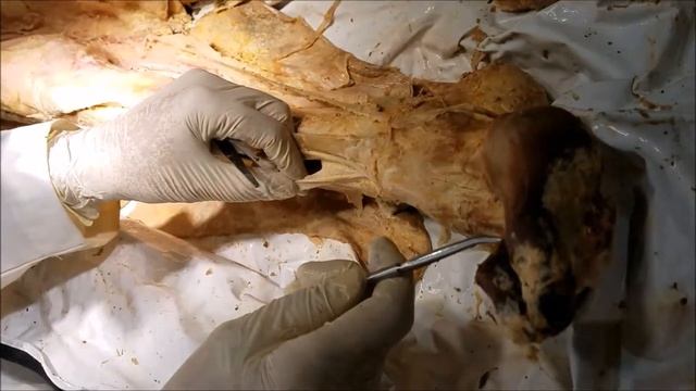 Leg Anterolateral Dissection-1 with Clinico-Functional Correlations - Sanjoy Sanyal смотреть онлайн