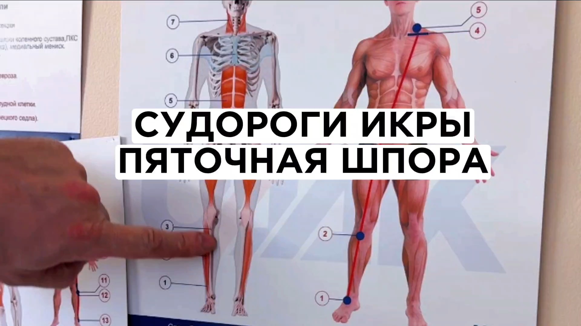 Почему появляются судороги и спазмы в ноге. Первое правило при пяточное шпоре. смотреть онлайн