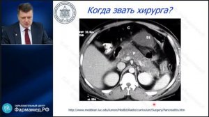 Интенсивная терапия острого панкреатита Лебединский К.М.