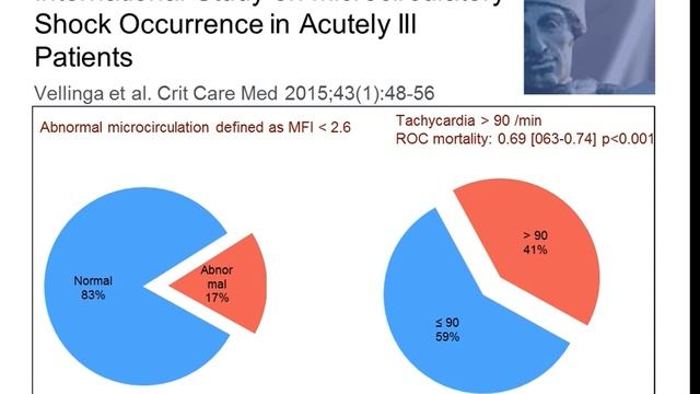 Incidence of microcirculatory shock and tissue hypoxia Jan Bakker 2015