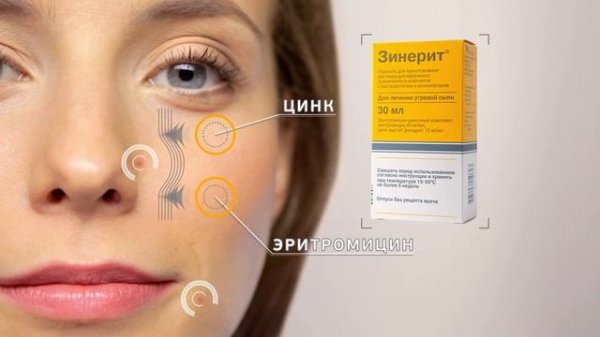 Зинерит 2014 / Zinerit 2014