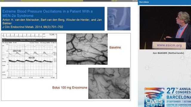 Inodilators Jan Bakker 2014