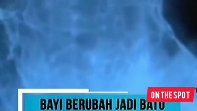 7 BAYI MENJADI BATU DI DALAM KANDUNGAN SANG IBU || PERSI ON THE SPOT смотреть онлайн