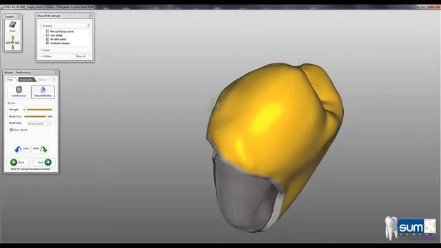 Sum3D Dental