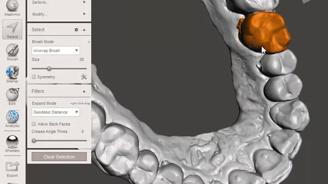 training case :virtual tooth extraction and ovate pontic site creation смотреть онлайн