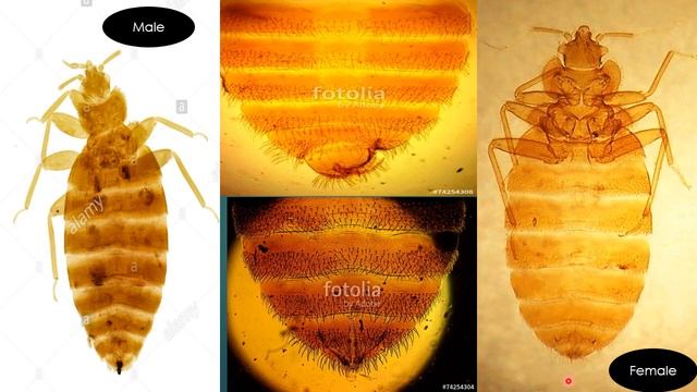 شرح عملي (lice, bugs, Ticks & Cyclops )Third section/ part 2 смотреть онлайн
