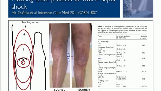 Tissue oxygen measurements Jan Bakker 2014