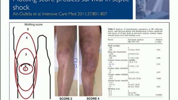 Tissue oxygen measurements Jan Bakker 2014