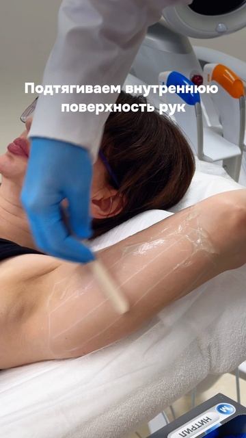 Подтягиваем внутреннюю поверхность рук: Ultraformer MPT смотреть онлайн