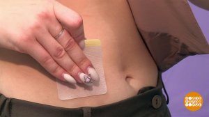 Пластыри для похудения: а они работают? Доброе утро. Фрагмент выпуска от 05.03.2025