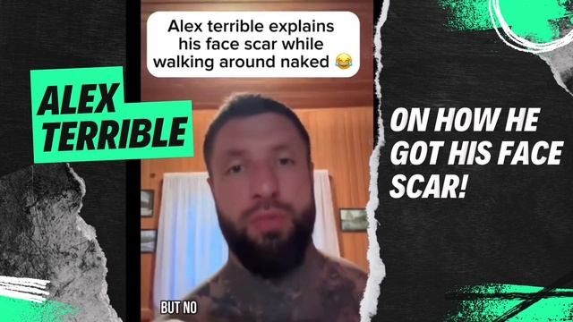 Alex Terrible On How He Got His Face Scar!