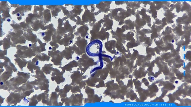 #50SecondBloodFilm: Loa Loa смотреть онлайн