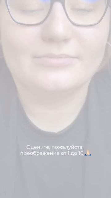 Стало ли лучше? Пишите в комментариях ❤️ #увеличениегуб #допосле