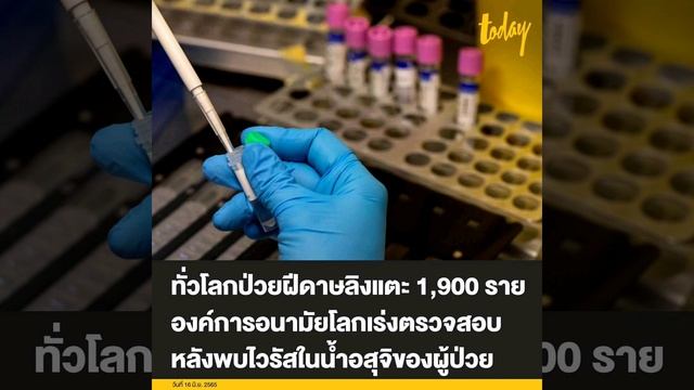 ทั่วโลกพบผู้ติดเชื้อฝีดาษลิง (Monkeypox) เพิ่มขึ้นแตะ 1,900 รายในกว่า 30 ประเทศ องค์การอนามัยโลกเร่ смотреть онлайн