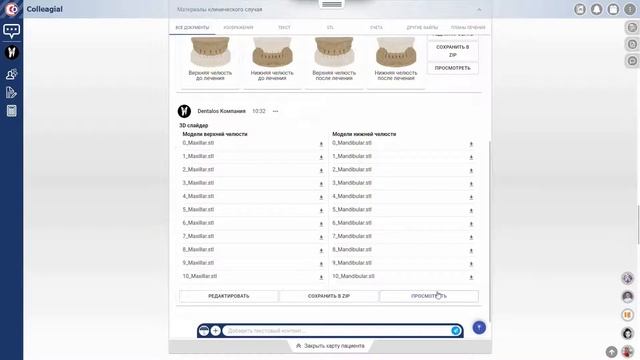 3D слайдер (ортодонтический 3D сетап) смотреть онлайн