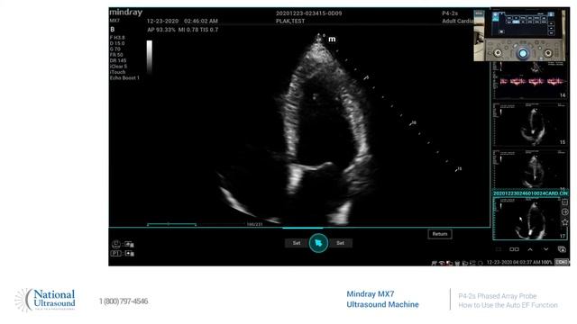 How to Use the Auto EF Function on the Mindray MX7 Ultrasound Machine смотреть онлайн
