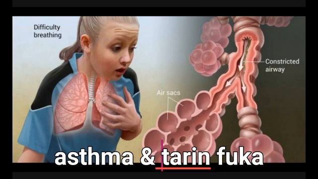 MAGANIN ASTHMA DA TARIN FUKA: Shirin kiwon lafiya kenan daga autarsoyayya shannel смотреть онлайн