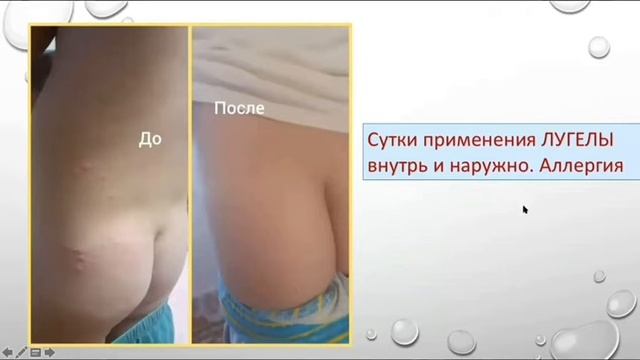 Алергия у детей. смотреть онлайн