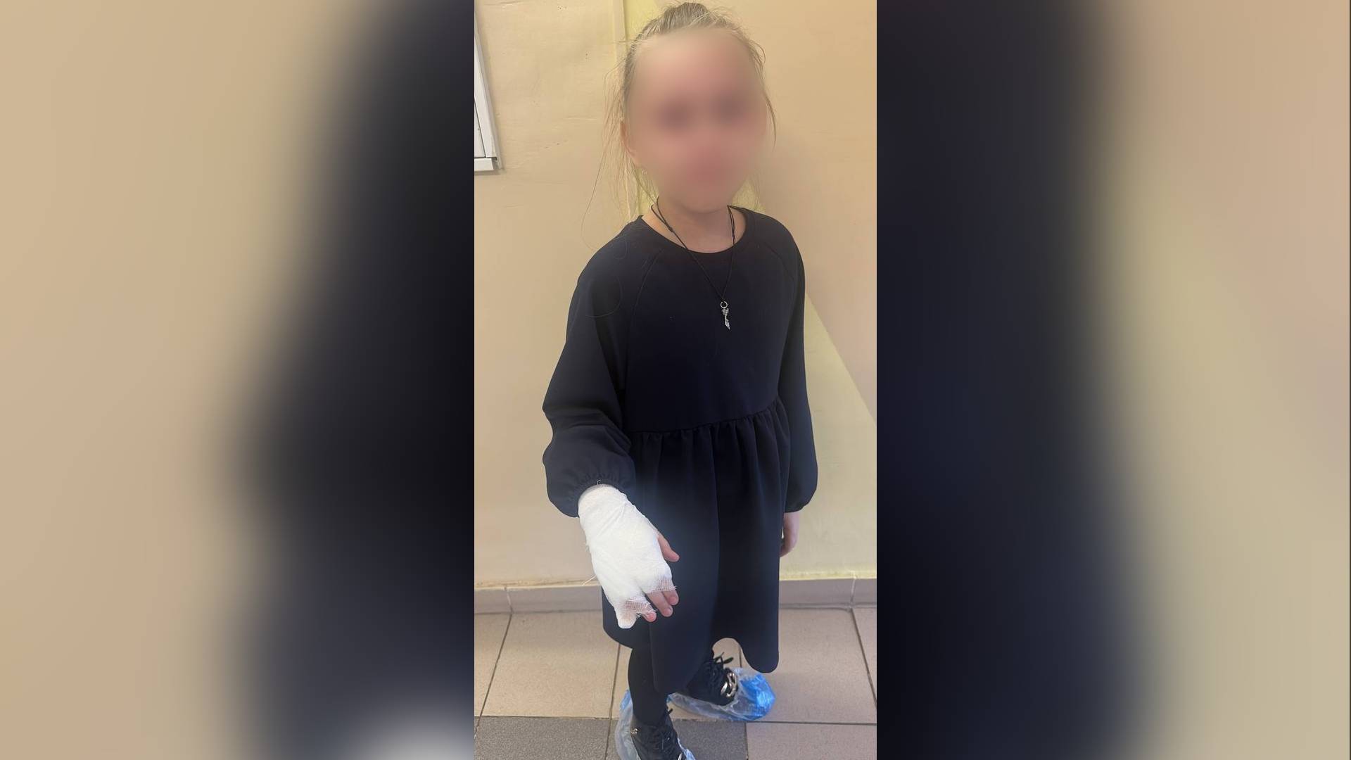 СОБАКА НАПАЛА НА РЕБЕНКА смотреть онлайн