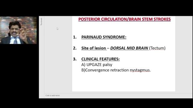 STROKE & HEMIPLEGIA PART - 4 , STROKE SYNDROMES