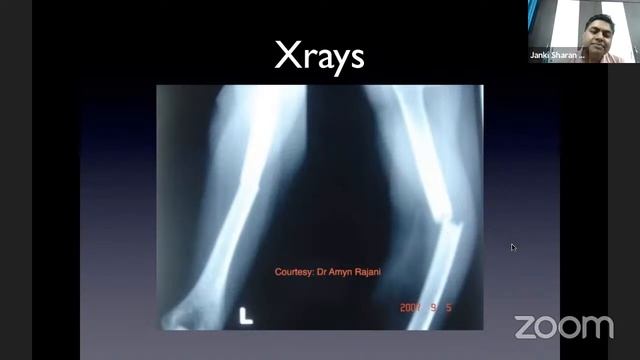 OREF India Webclass – Art of Mobile photography in Orthopaedics – Dr. Neeraj Bijlani смотреть онлайн