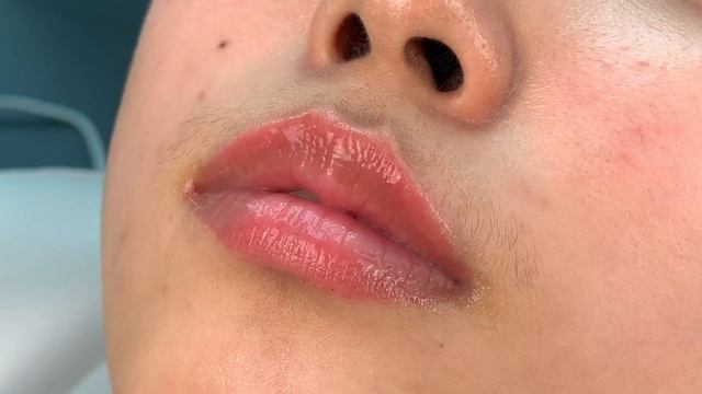 F-PERFECT LIPS - Natural Lip Volume And Colour - No Embroidery No Filler Enhancement