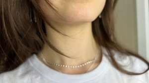 Диффузный токсический зоб (диффузно токсический зоб) ДТЗ щитовидной железы Гипертиреоз