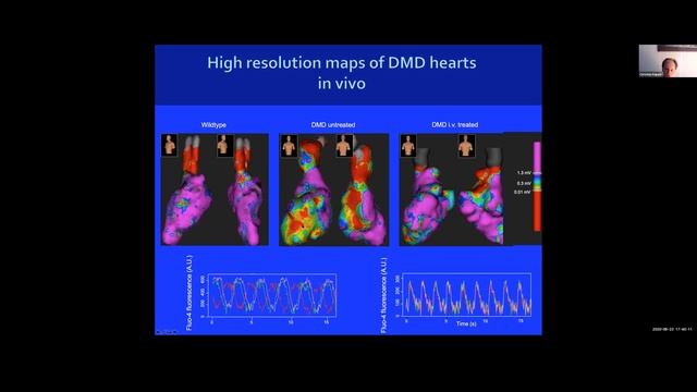 Prof Mauro Giacca, Christian Kupatt and Seppo Yla-Herttula - "Cardiac gene therapy" смотреть онлайн