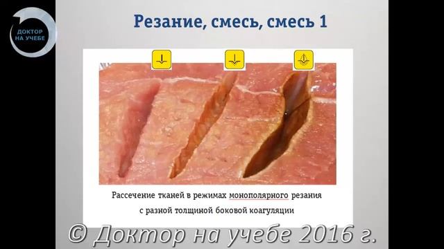 СДВ БДС Л №9 Широкополосная радиоволновая хирургия принцип метода нÐ смотреть онлайн