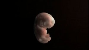 Видеогид. 7 неделя. Внематочная беременность