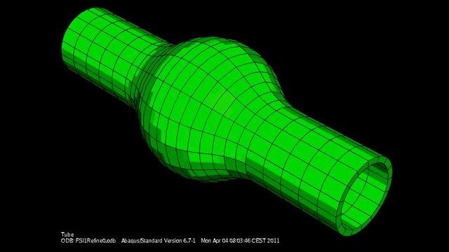 FSI simulation of large aneurysm смотреть онлайн