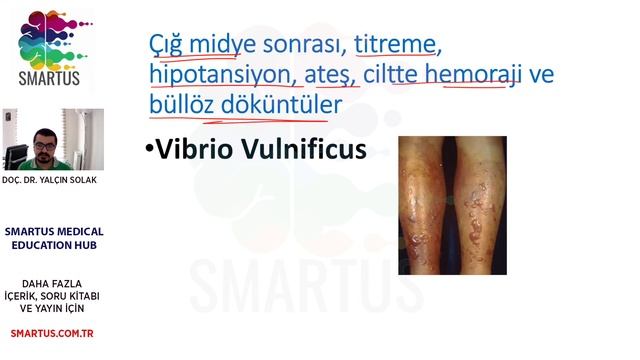 ENFEKSİYON HASTALIKLARI 1. BÖLÜM - TUS & YDUS İÇİN SPOTLAR - TUS VE YDUS HAZIRLIK EĞİTİMLERİ смотреть онлайн