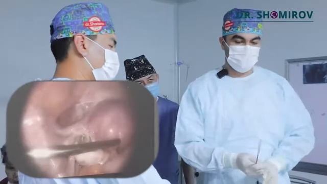 Bachadondan Tashqari Homiladorlik