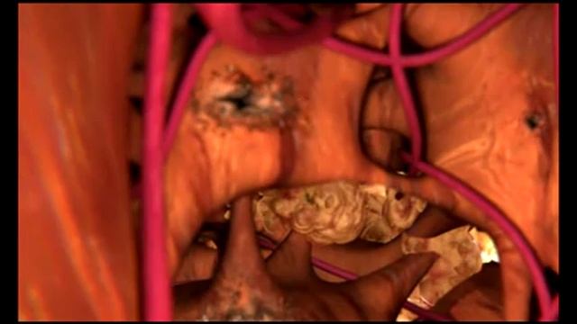 ЗвониДок - наркологическая помощь