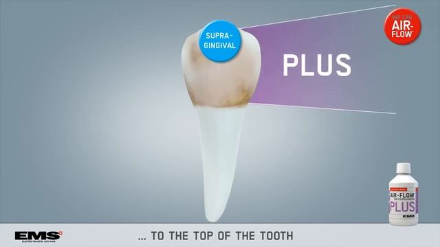 EMS Air-Flow Plus - универсално решение за полиране на зъби смотреть онлайн