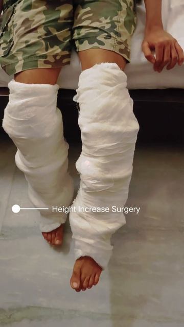 height Increase Surgery | Limb lengthening surgery | Dr Amar Sarin смотреть онлайн