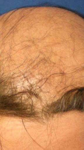 Лысинки не болят, а коленочки беспокоят.