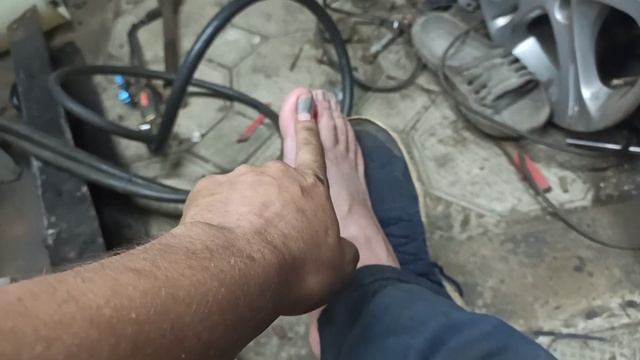 Как я сломал палец на ноге кронштейном рессоры от газели. Сломал палец на ноге. Перелом пальца. смотреть онлайн
