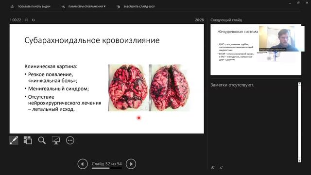 12 Кровостнобжение мозга