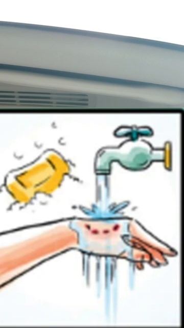 PENCEGAHAN DAN PENGOBATAN RABIES #rabies #health #animal смотреть онлайн