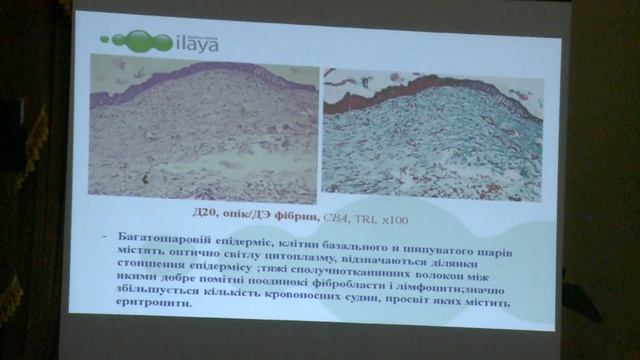 Використання клітинних технологій у лікуванні глибоких опіків смотреть онлайн