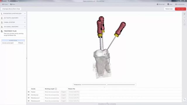 Dentsply Sirona 3D Endo software смотреть онлайн