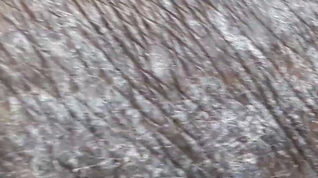 Tinea Corporis смотреть онлайн